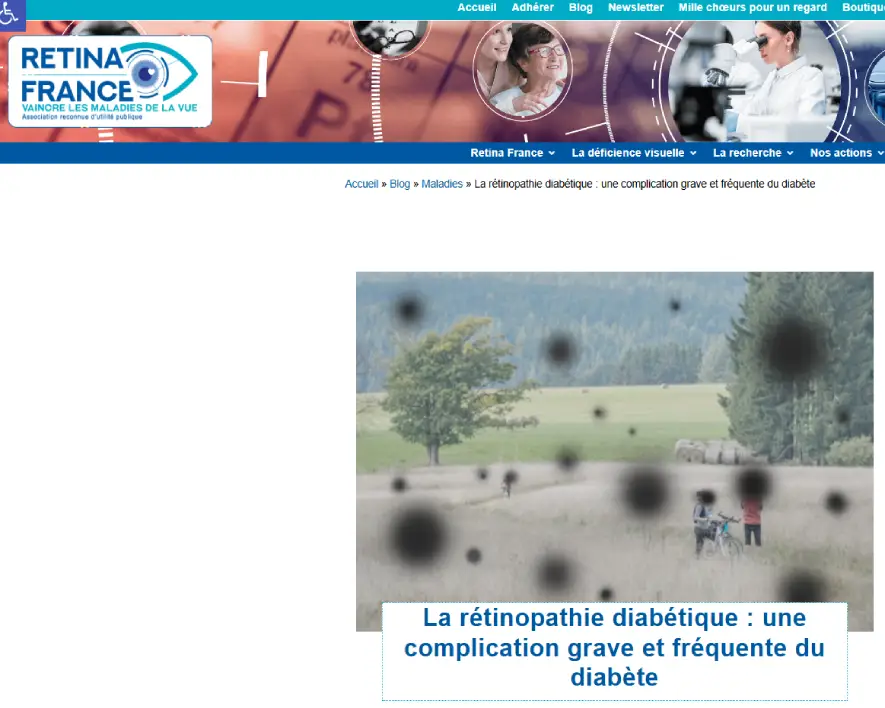 page web sur les rétinopathies